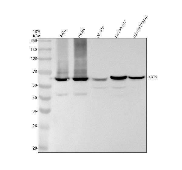 Anti-Cytokeratin 5 (C-term) KRT5 Rabbit Monoclonal Antibody