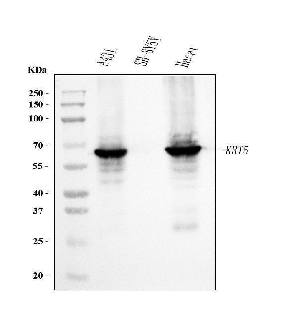 Anti-Cytokeratin 5 Antibody Picoband® (monoclonal, 9H2F8)