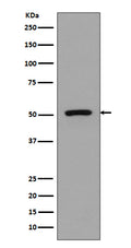 Western blot analysis of FLI1 expression in Jurkat cell lysate.