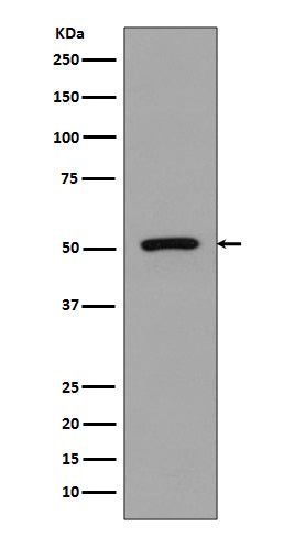 Western blot analysis of FLI1 expression in Jurkat cell lysate.