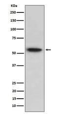 Western blot analysis of TRAF2 expression in Raji cell lysate.