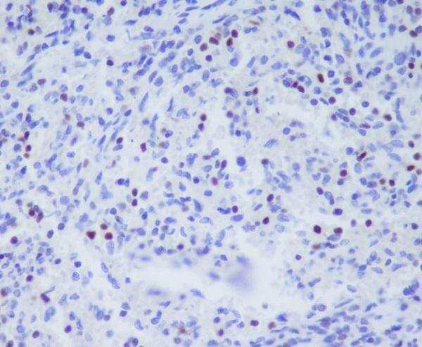 Immunohistochemical analysis of paraffin-embedded human spleen, using T-bet/Tbx21 Antibody.