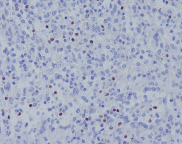 Immunohistochemical analysis of paraffin-embedded human spleen, using TBX21 Antibody.