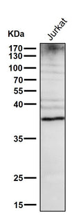 All lanes use the Antibody at 1:1W dilution for 1 hour at room temperature.
