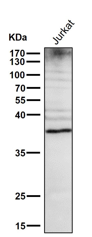 All lanes use the Antibody at 1:1W dilution for 1 hour at room temperature.