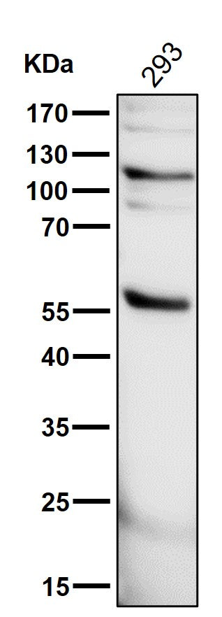 All lanes use the Antibody at 1:3K dilution for 1 hour at room temperature.