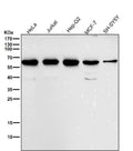 All lanes use the Antibody at 1:2K dilution for 1 hour at room temperature.