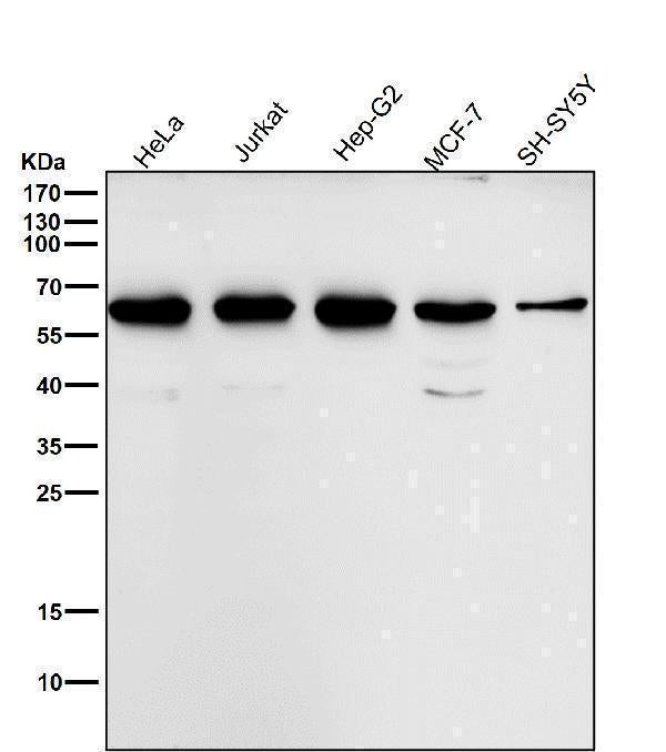 All lanes use the Antibody at 1:2K dilution for 1 hour at room temperature.