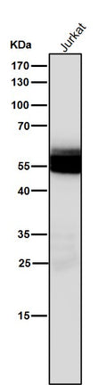 All lanes use the Antibody at 1:1K dilution for 1 hour at room temperature.