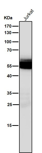 All lanes use the Antibody at 1:1K dilution for 1 hour at room temperature.