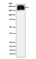 Western blot analysis of Niemann Pick C1 expression in HepG2 cell lysate.