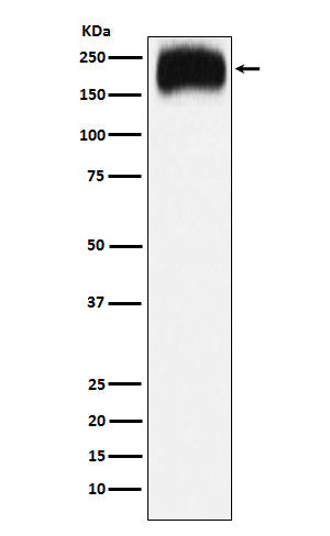 Western blot analysis of Niemann Pick C1 expression in HepG2 cell lysate.