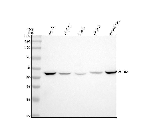 Anti-AGTR2/Angiotensin Ii Type 2 Receptor Rabbit Monoclonal Antibody