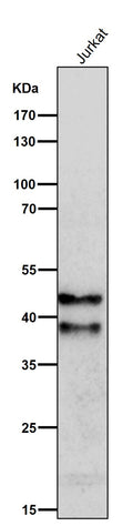 All lanes use the Antibody at 1:1K dilution for 1 hour at room temperature.