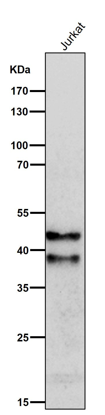 All lanes use the Antibody at 1:1K dilution for 1 hour at room temperature.
