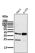 All lanes use the Antibody at 1:1K dilution for 1 hour at room temperature.