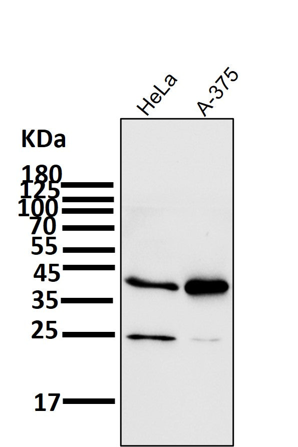 All lanes use the Antibody at 1:1K dilution for 1 hour at room temperature.