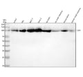 Anti-TOP1/Topoisomerase I Rabbit Monoclonal Antibody