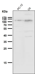 All lanes use the Antibody at 1:2K dilution for 1 hour at room temperature.
