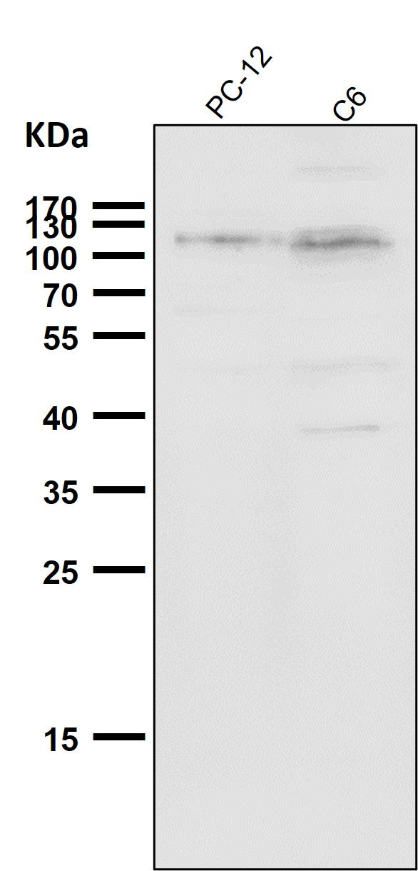 All lanes use the Antibody at 1:2K dilution for 1 hour at room temperature.