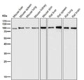 All lanes use the Antibody at 1:3k dilution for 1 hour at room temperature.