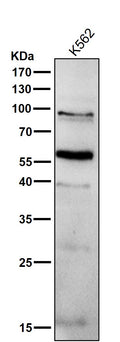 All lanes use the Antibody at 1:1K dilution for 1 hour at room temperature.