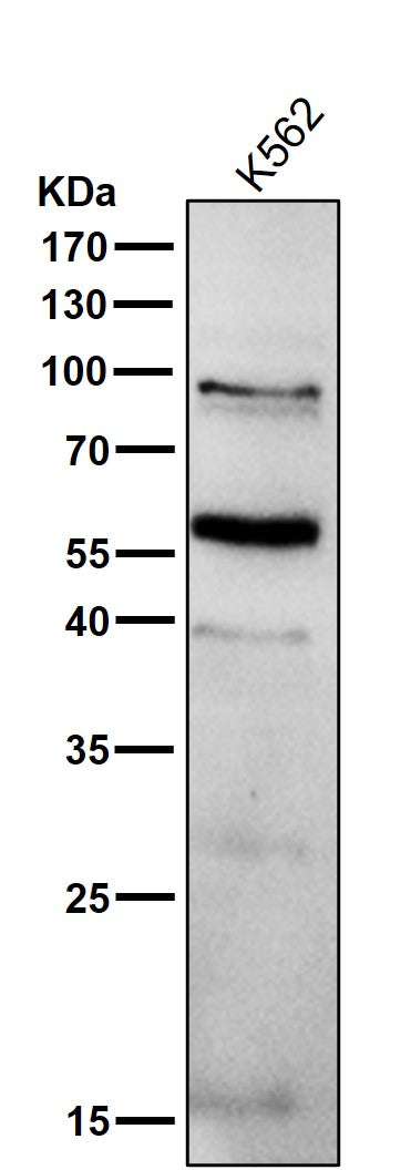 All lanes use the Antibody at 1:1K dilution for 1 hour at room temperature.