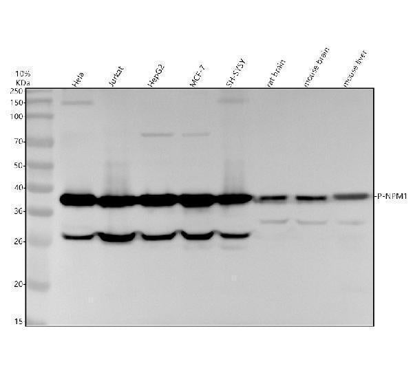 Anti-Phospho-Nucleophosmin (S125) Rabbit Monoclonal Antibody