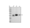 Anti-Lipocalin-2 LCN2 Rabbit Monoclonal Antibody