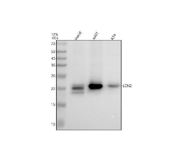 Anti-Lipocalin-2 LCN2 Rabbit Monoclonal Antibody