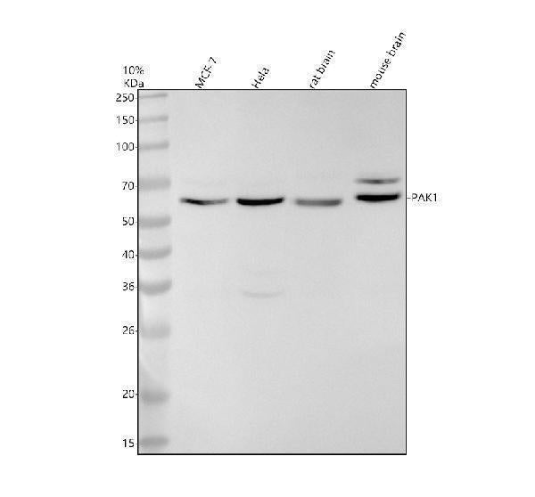 Anti-PAK1 Monoclonal Antibody
