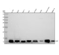 Anti-beta 2 Microglobulin B2M Rabbit Monoclonal Antibody
