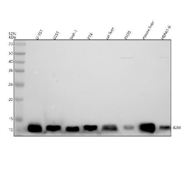 Anti-beta 2 Microglobulin B2M Rabbit Monoclonal Antibody