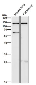 All lanes use the Antibody at 1:2K dilution for 1 hour at room temperature.