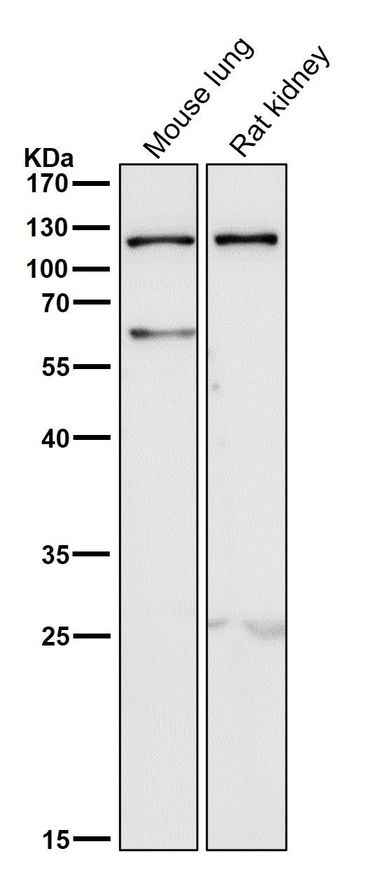 All lanes use the Antibody at 1:2K dilution for 1 hour at room temperature.