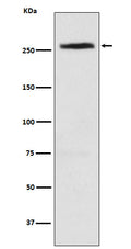Western blot analysis of CAD expression in HeLa cell lysate.