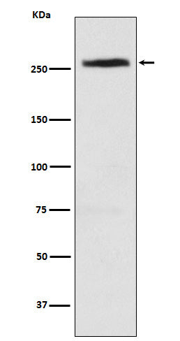 Western blot analysis of CAD expression in HeLa cell lysate.