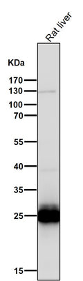 All lanes use the Antibody at 1:1K dilution for 1 hour at room temperature.