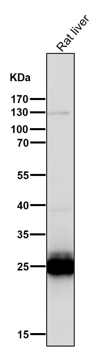 All lanes use the Antibody at 1:1K dilution for 1 hour at room temperature.