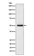 Western blot analysis of Cytochrome P450 2C9 expression in HepG2 cell lysate.