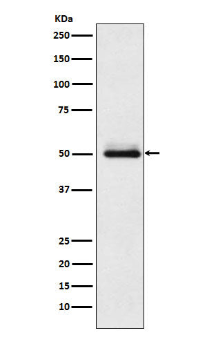 Western blot analysis of Cytochrome P450 2C9 expression in HepG2 cell lysate.