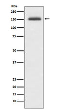 Western blot analysis of Integrin alpha 4 expression in Jurkat cell lysate.