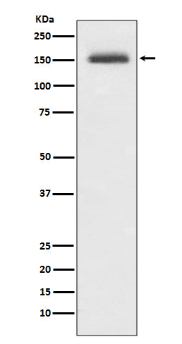 Western blot analysis of Integrin alpha 4 expression in Jurkat cell lysate.