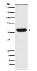Western blot analysis of SERPINC1 expression in human plasma lysate.