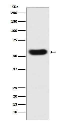 Western blot analysis of SERPINC1 expression in human plasma lysate.