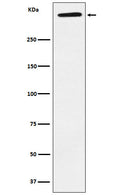 Western blot analysis of ApoA expression in Human plasma lysate.
