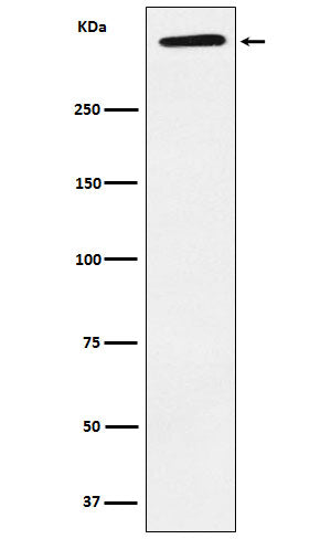Western blot analysis of ApoA expression in Human plasma lysate.