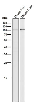 All lanes use the Antibody at 1:1K dilution for 1 hour at room temperature.