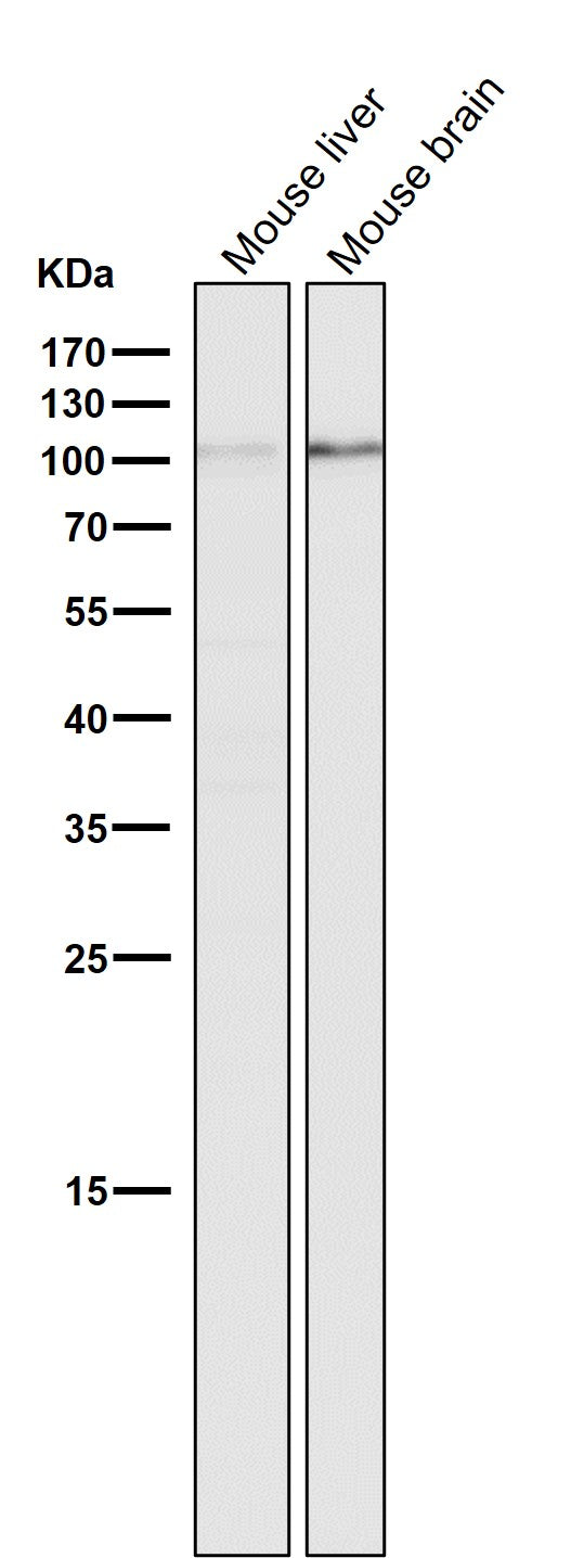 All lanes use the Antibody at 1:1K dilution for 1 hour at room temperature.