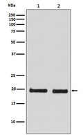Western blot analysis of Skp1 expression in (1) 293T cell lysate; (2) NIH/3T3 cell lysate.